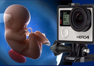 GoPro Cameras GoProLife